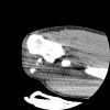 SPORK, NICO - 22.03.1976 - 02.08.2022 - CT obere Extremität - 17:51:17
